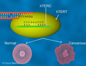 Activity of Telomerase - Animated Atlas of Breast and Gastric Cancer Activity of Telomerase - Animated Atlas of Breast and Gastric Cancer